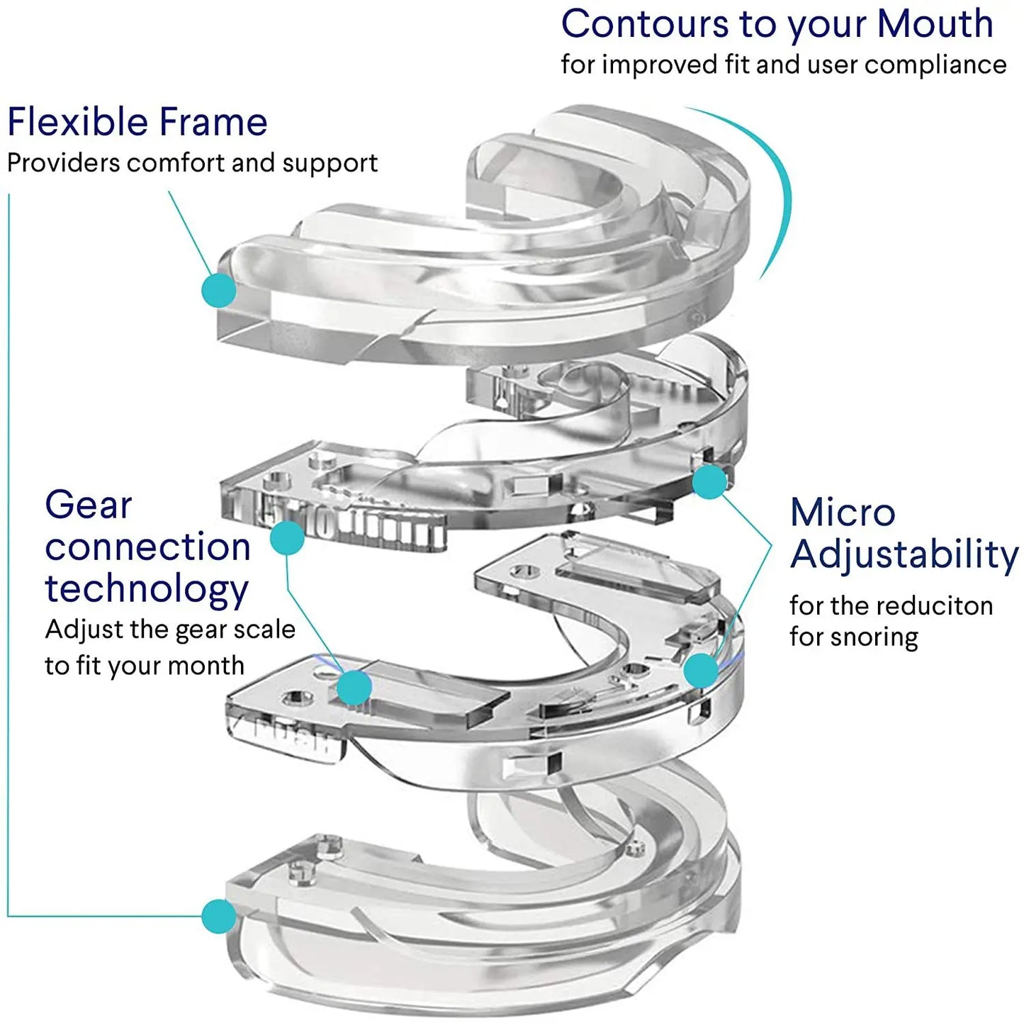 SnoreSentry™️ Anti Snoring mouthpiece by Barlev's